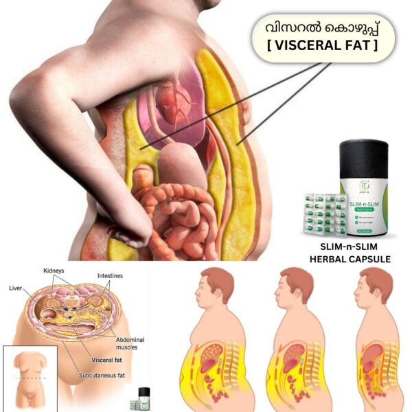 Best Ayurvedic weight loss capsule in Kerala, India